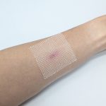 Sensitti Sofgau Paraffin Gauze Wound Dressing 5x5cm Application